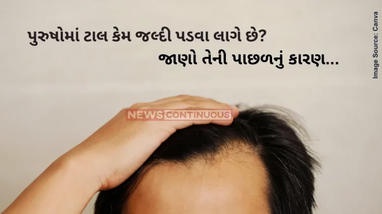 what cause baldness in men