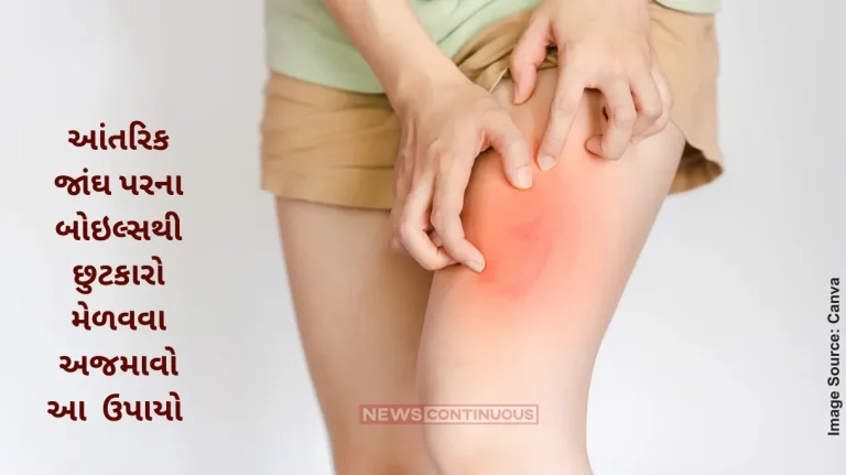 Home Remedies Natural Solutions To Get Rid Of Boils