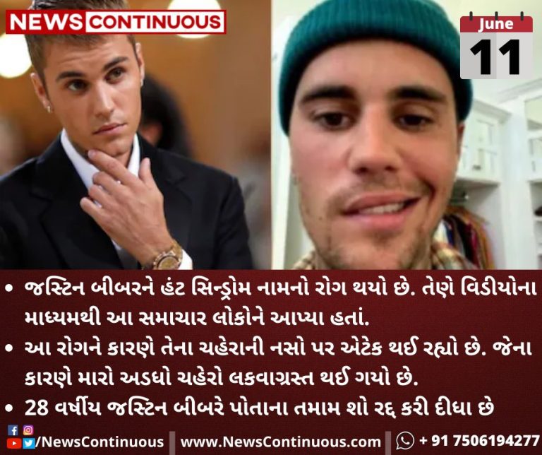 Justin-Bieber-cancels-shows-after-half-of-face-left-paralysed-by-virus_11zon