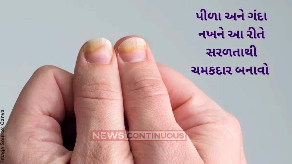 Know how to clean your nails