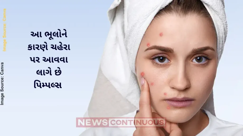 Pimples- These mistakes are causing pimple on your face