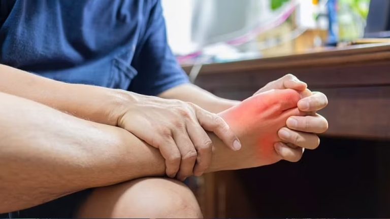 Eating this dry fruit will help you with Uric Acid problems