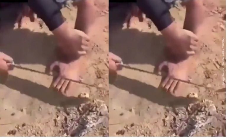 Punjab Horror! Man’s fingers chopped off with sword amid ‘lawlessness’ in the state Punjab Horror! Man’s fingers chopped off with sword amid ‘lawlessness’ in the state