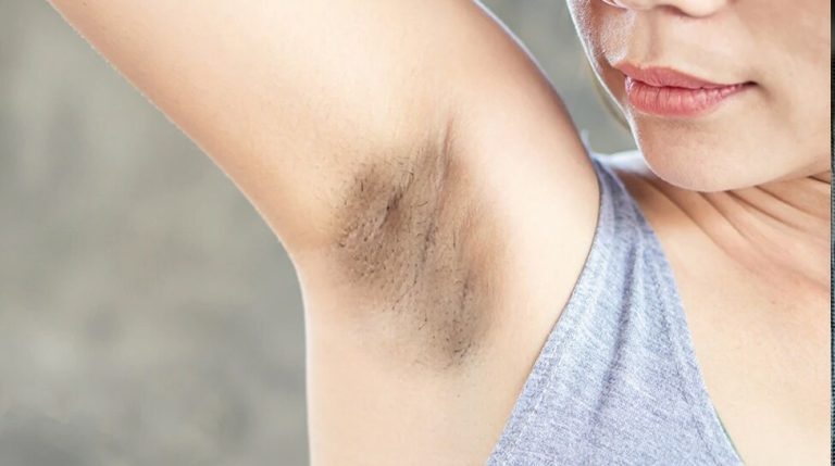 Dark Underarms: home remedies for dark underarms