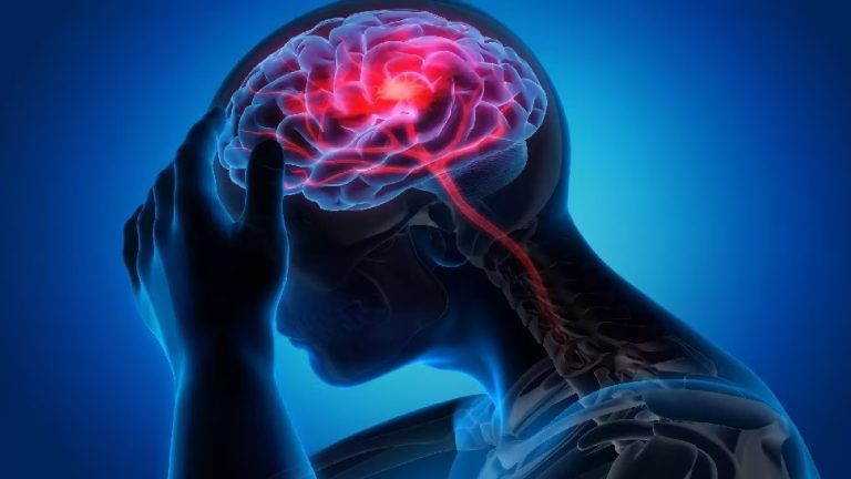 Stroke Symptoms-Learn how to protect yourself from having a stroke