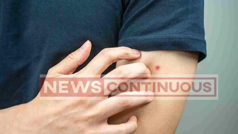 _strange effect of a small insect bite; A carnivorous man became a vegetarian_11zon_11zon strange effect of a small insect bite; A carnivorous man became a vegetarian