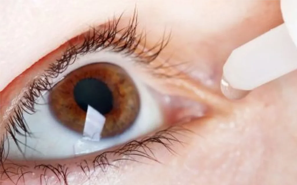 ahmedabad-12-thousand-eye-conjunctivitis-cases-reported-in-ahmedabad-in-a-single-week