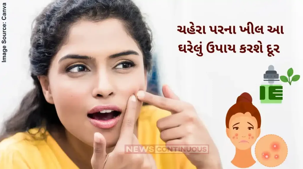 Pimple Remedies How To Use Tea Tree Oil For Acne and Pimple