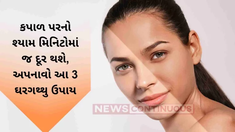 Homemade Remedies to remove forehead tanning Homemade Remedies to remove forehead tanning