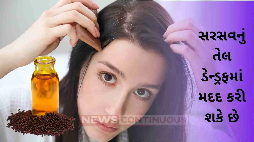 Mustard Oil Can Help With Dandruff—Here's How