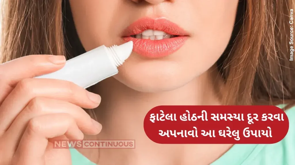 Chapped Lips Perfect home remedies for chapped lips