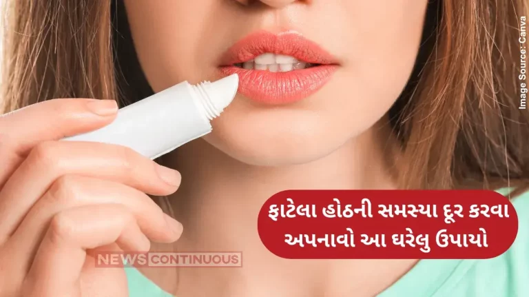 Chapped Lips Perfect home remedies for chapped lips