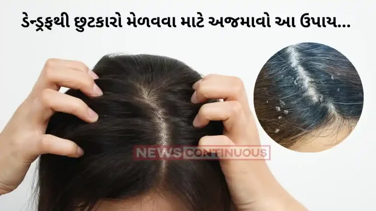 DIY curd hair masks to sort your hair problems DIY curd hair masks to sort your hair problems