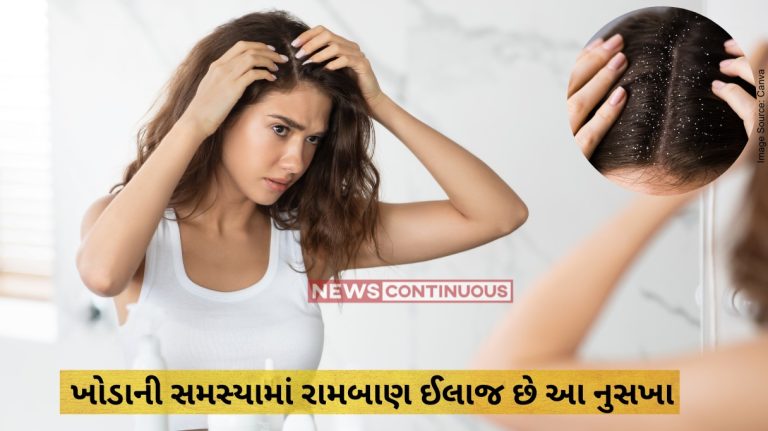 Dandruff removal : Effective home remedies to combat dandruff this winter