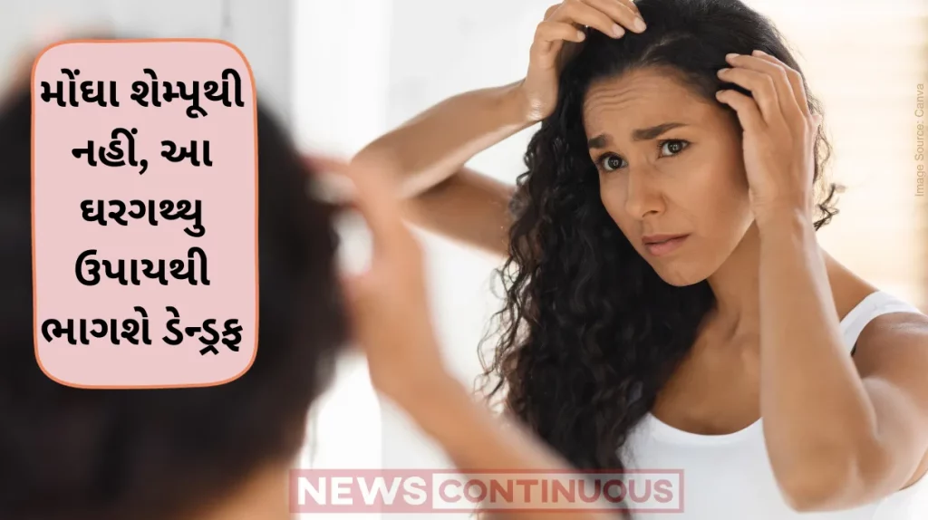 Dandruff remedies Effective Dandruff Solutions For Clean Scalp This Winter Season