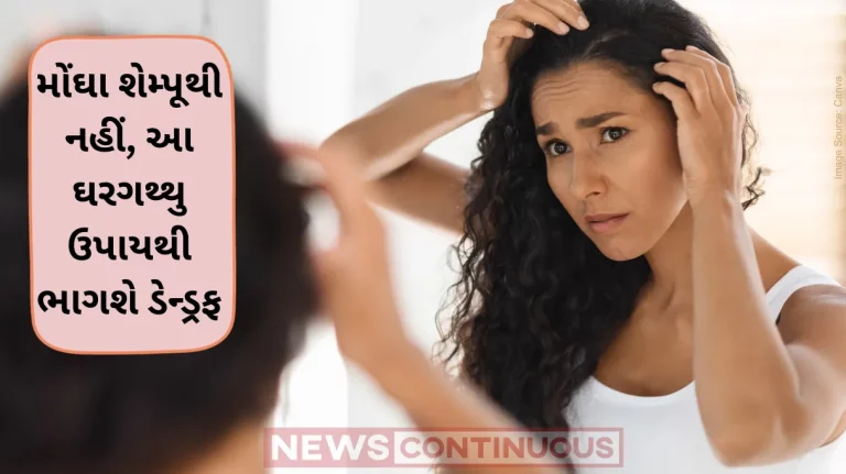 Dandruff remedies Effective Dandruff Solutions For Clean Scalp This Winter Season