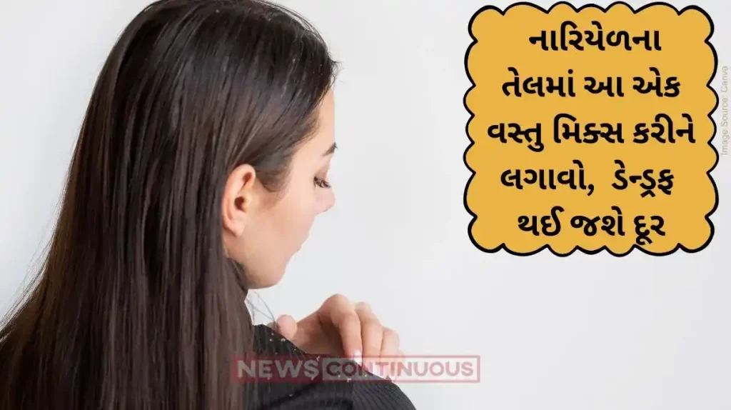 Dandruff Home Remedies Home remedies to fight off dandruff efficiently