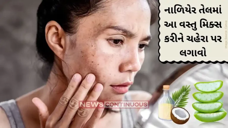 face pigmentation Aloe Vera and Coconut Oil – Natural Remedies for Hyperpigmentation