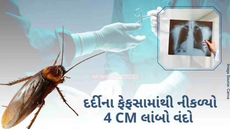 In Kerala, doctors removed a cockroach from the lungs of a patient with severe breathing problems