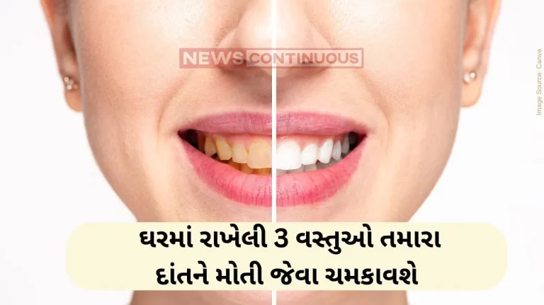 Teeth Whitening How to whiten your teeth naturally with home remedies Teeth Whitening How to whiten your teeth naturally with home remedies