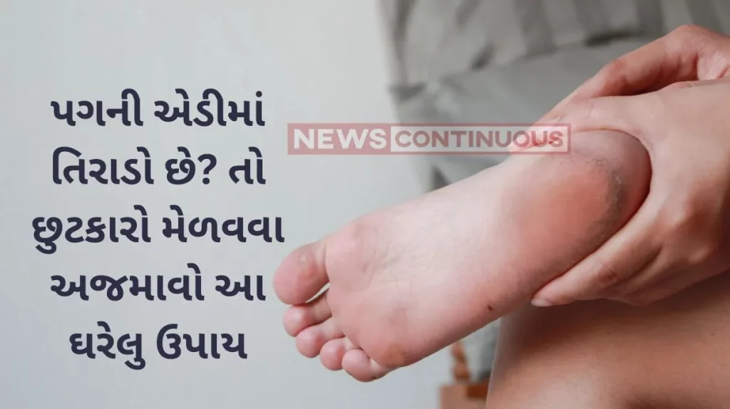 Cracked Heel Remedies 5 Effective Kitchen Remedies to Heal Cracked Heels