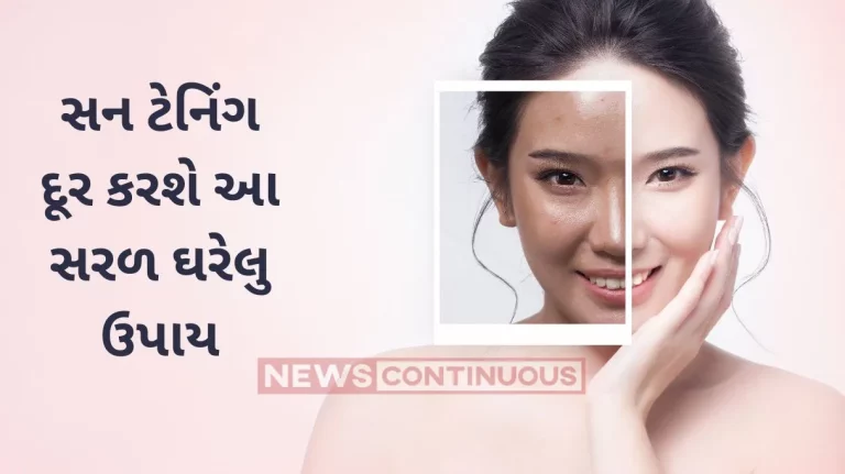 Sun Tan If you got sun tan due to sun, 5 natural methods to remove sun tan are best Sun Tan If you got sun tan due to sun, 5 natural methods to remove sun tan are best