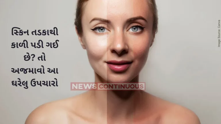 Tanning Home Remedy How To Get Rid Of A Sun Tan , 5 Effective Home Remedies