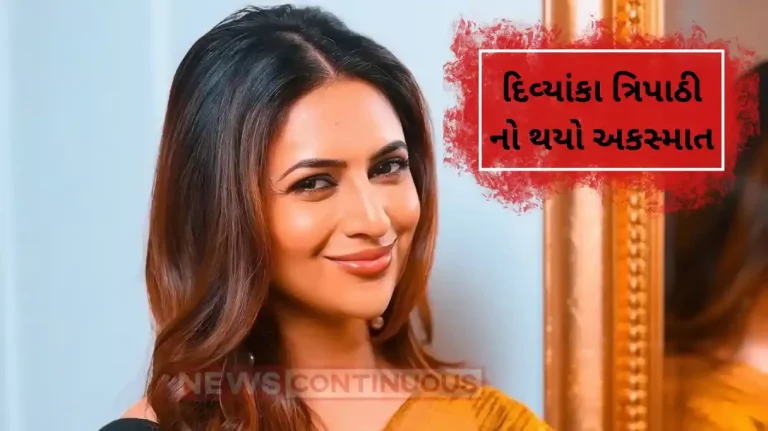 divyanka tripathi meets with accident husband vivek dahiya share health update