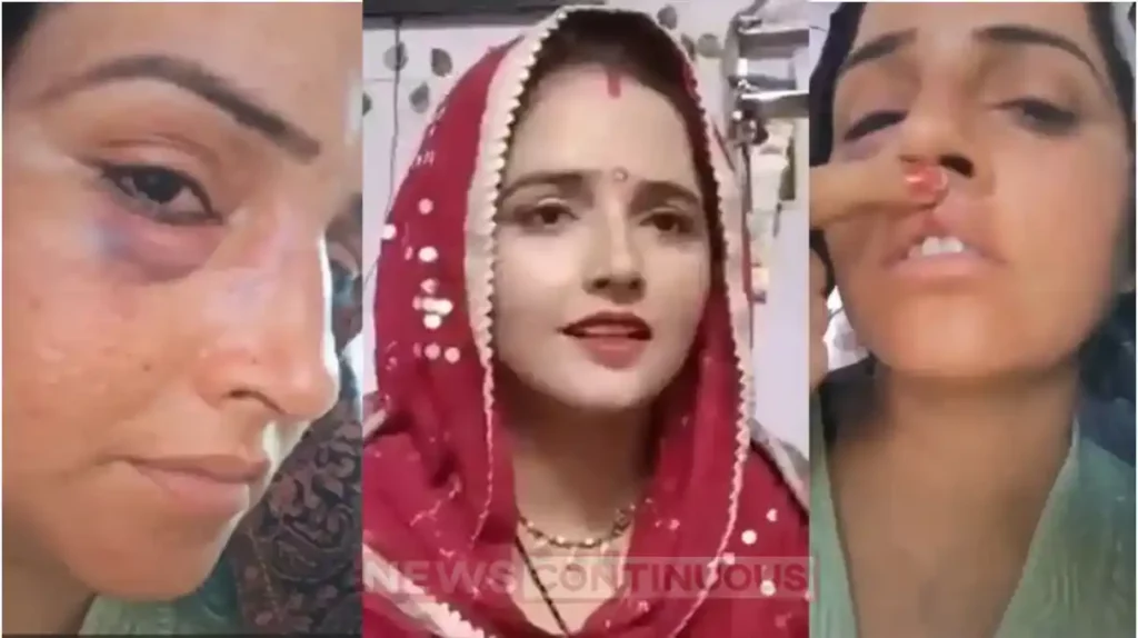 seema haider shows swollen eye lip injury on face in viral video