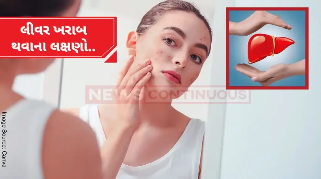 Health If these 5 symptoms appear on your face, then understand that your liver is going bad... Know more..