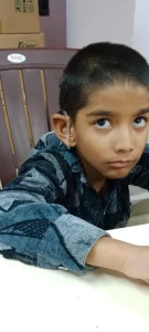 Successful 'Cochlear Implant' Surgery at Surat Civil HospitalThree Bugs, Deaf and Mute from Birth, Get Nine Lives