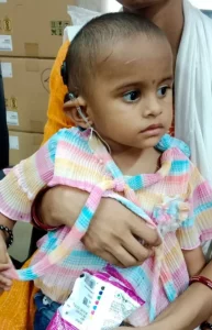 Successful 'Cochlear Implant' Surgery at Surat Civil HospitalThree Bugs, Deaf and Mute from Birth, Get Nine Lives