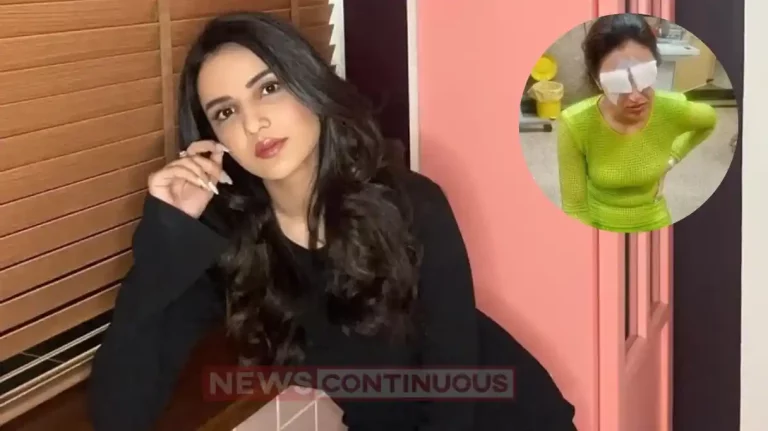 jasmin bhasin loosing eyesight due to cornea