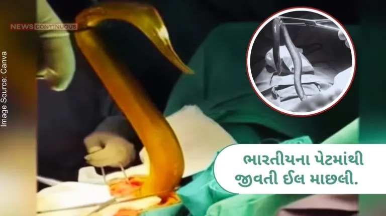 alive eel fish from an Indian's stomach in Vietnam.