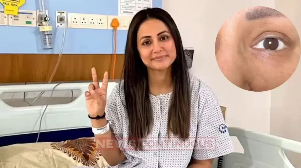 hina khan shares the photo of her last eyelid