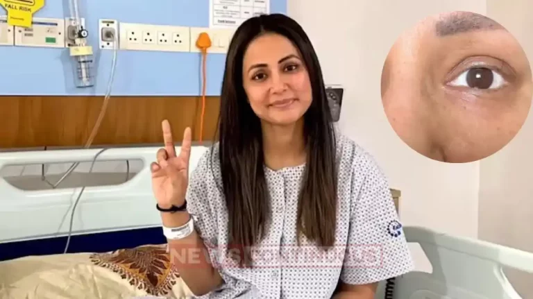 hina khan shares the photo of her last eyelid