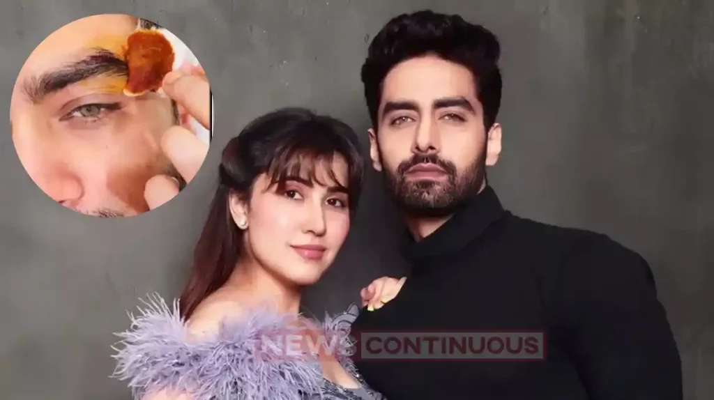 YRKKH armaan poddar aka rohit purohit got injured wife sheena gave update