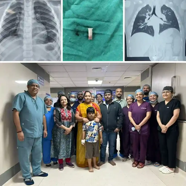 Ahmedabad’s Civil Hospital is serving patients round the clock. Ahmedabad's Civil Hospital is serving patients round the clock.