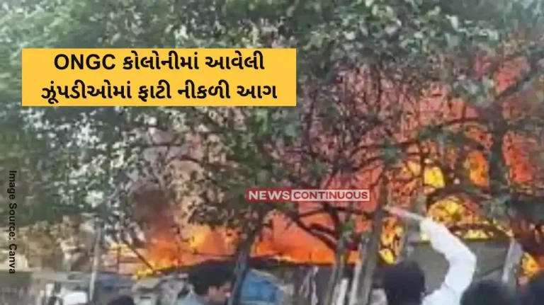 Bandra Fire Fire in Bandra East’s ONGC Colony, Several shanties ablaze, no injuries reported