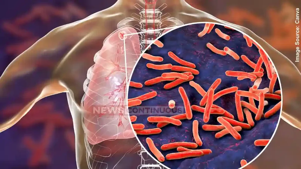 TB Mukt Bharat Abhiyan Gujarat's remarkable performance under the TB Mukt Bharat Abhiyan