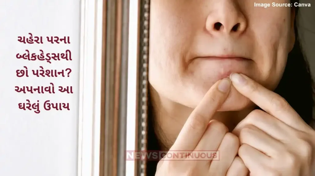 Blackheads Home Remedies Easy ways to remove blackheads from face naturally at Home