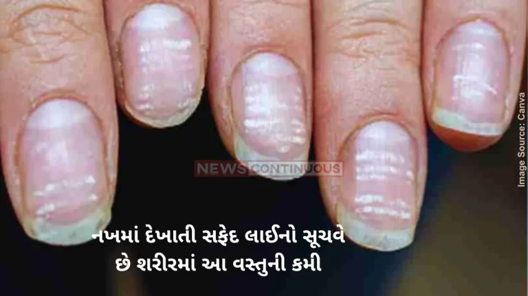 White Spots On Nails What are the tiny white spots on the nails Top functional medicine doc says it could be a warning sign