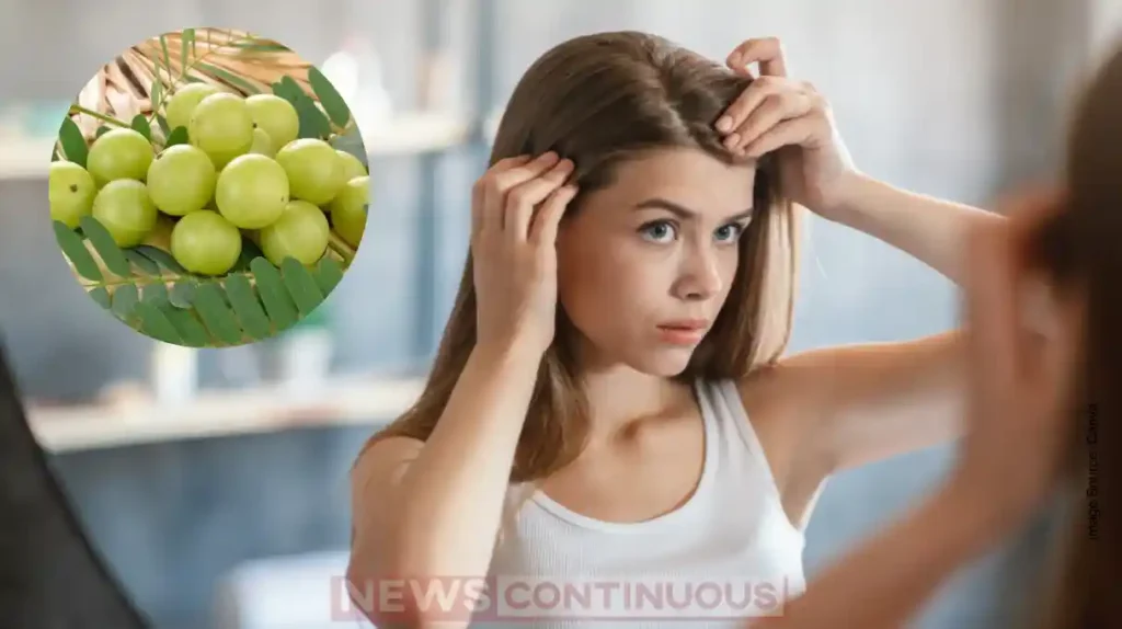 Turn White Hair Black Naturally with Just 2 Spoons of Amla Powder