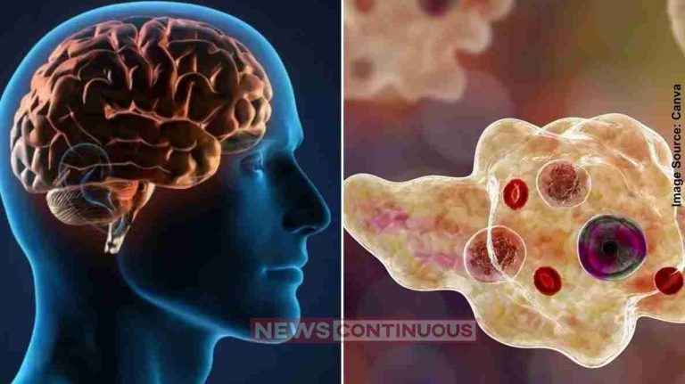Brain-Eating-Amoeba-કેરળમાં-આ-બીમારી-એ-ઉચક્યું-માથું-અત્યાર-સુધીમાં-19-મૃત્યુ