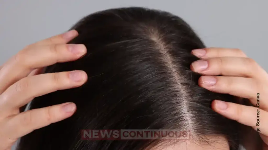 Home Remedies for White Hair Mix Coffee in Onion Peel and Say Goodbye to Expensive Hair Dyes