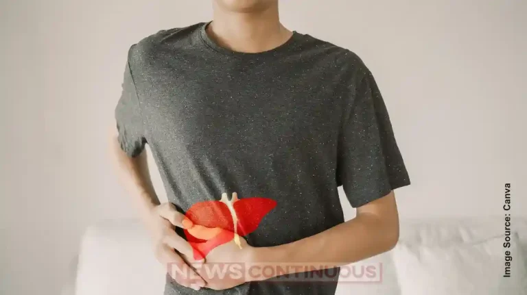 Non-Alcoholic Fatty Liver Rising in Children: Is Your Food Causing It?