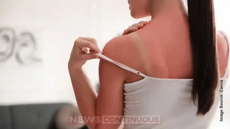 Remove Skin Tanning Naturally with This Homemade Soap – Easy Recipe Inside!