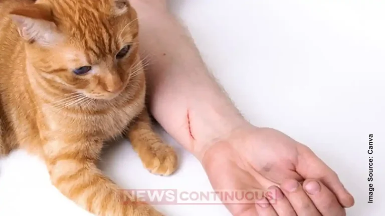 Cat Scratch Disease: Too Much Affection Can Be Risky