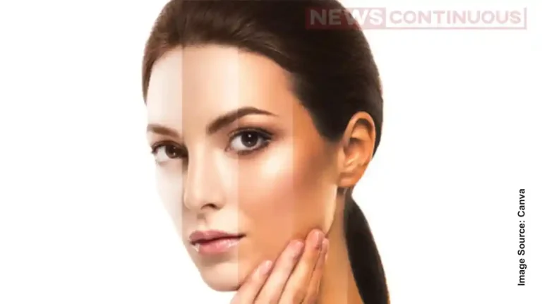 How Fair Are You Really? Check This Body Part to Know Your True Skin Tone