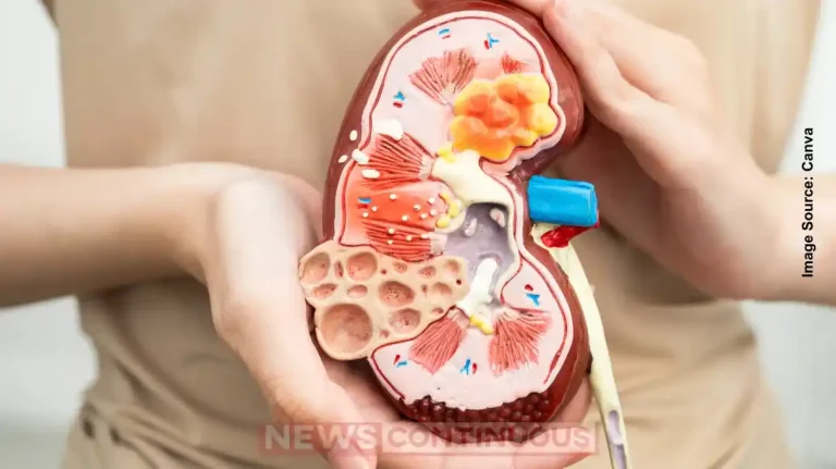 Kidney Health: Lack of Sleep Could Signal Kidney Disease, Don’t Ignore